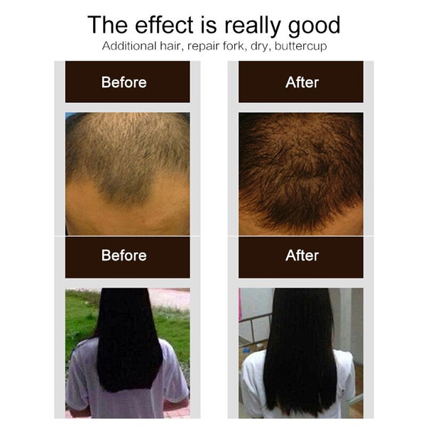 Ginger Hair Growth Spray for Strong Healthy Hair