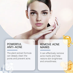 Acne Soothing Serum for Hydrated Clear and Balanced Skin