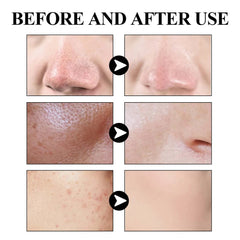 West & Month Blackhead Mud Mask for Clear Refreshed Skin