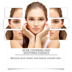Acne Soothing Serum for Hydrated Clear and Balanced Skin