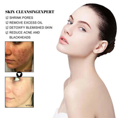 West & Month Blackhead Mud Mask for Clear Refreshed Skin