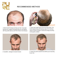 Ginger Hair Growth Spray for Strong Healthy Hair