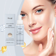 Acne Soothing Serum for Hydrated Clear and Balanced Skin