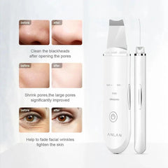 Ultrasonic Skin Scrubber Pen for Deep Facial Cleansing Tool